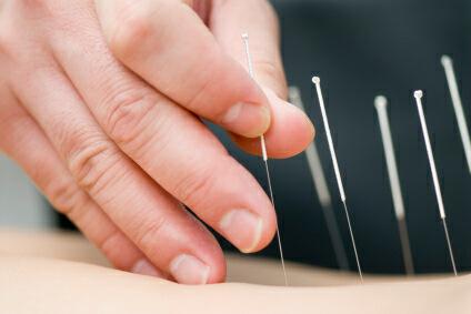 Kingscliff Acupuncture  Massage